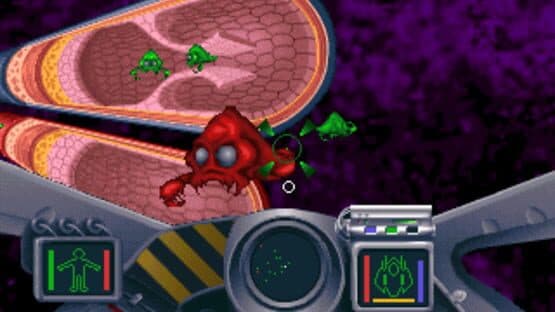 Screenshot of Bodyworks Voyager: Mission in Anatomy